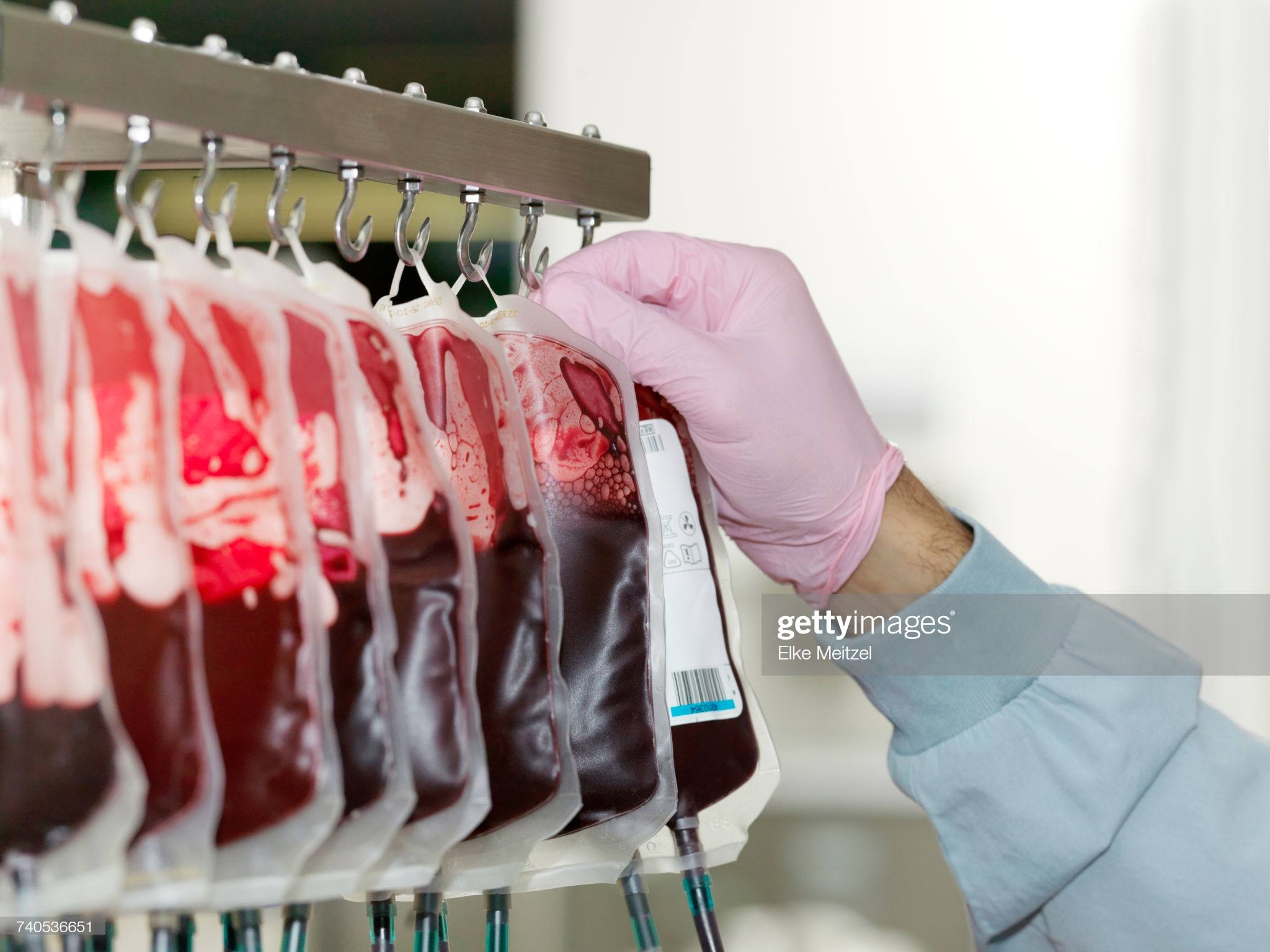 Menguak Mitos dan Fakta Donor Darah yang Wajib Kamu Ketahui