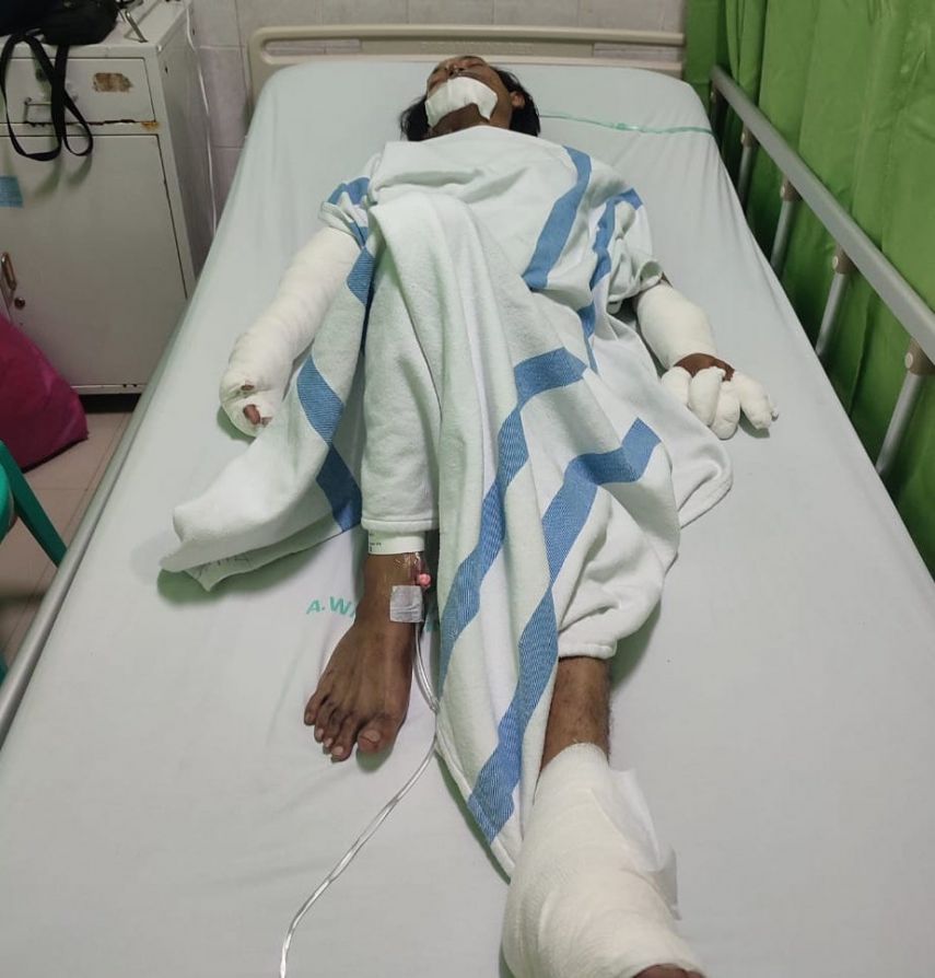 Wartawan Samarinda Pos Jadi Korban Mobil Pengetap yang Meledak, Alami Luka Bakar 5 Persen, Masih Dirawat di RSUD AW Sjahranie