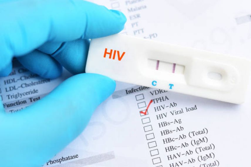 Kasus HIV Aids Kaltim Capai 5.000, Berikut Jenis Tes HIV Aids yang Bisa Kamu Lakukan!