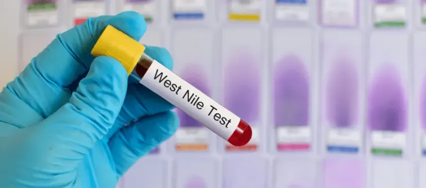 Belum Ada Obatnya! 100 Orang Terinfeksi Virus West Nile di Israel: Ini Gejala dan Dampak