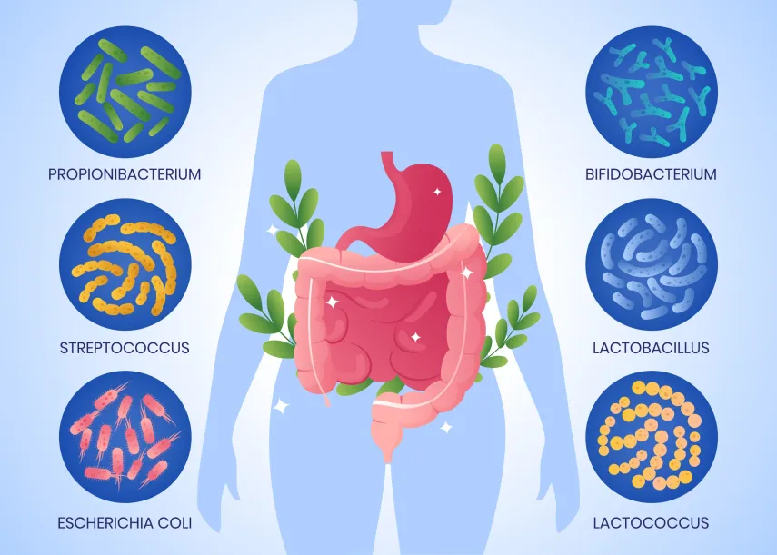 Usus Buntu Bisa Sebabkan Kematian: IDI Burmeso Berikan 3 Tips Cegah Sedari Dini