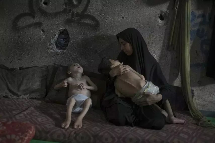 Anak-Anak Gaza Terancam Alami Kerusakan Fisik dan Otak Permanen akibat Kelaparan